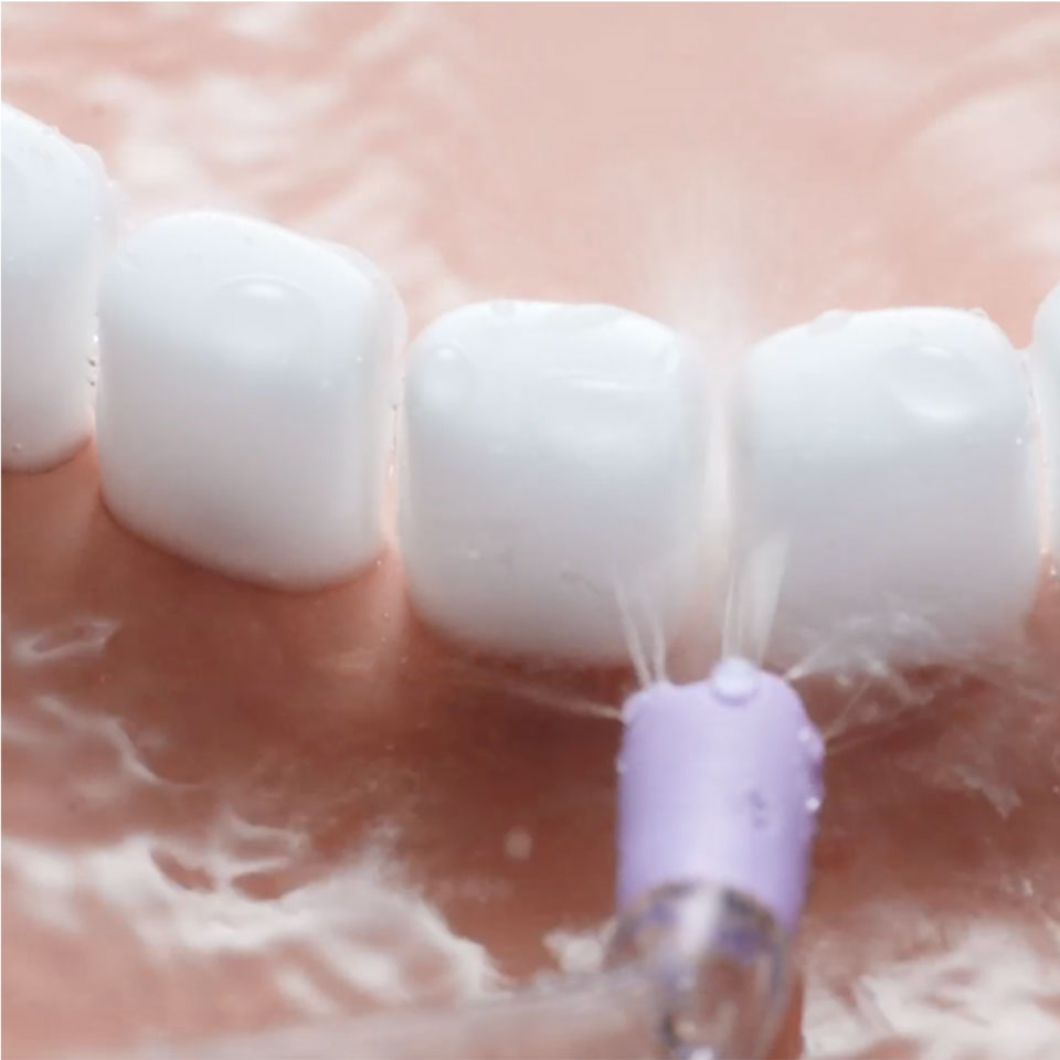 Quad Stream spraying between teeth