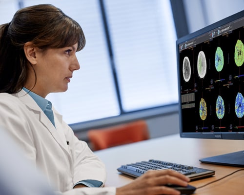Diagnostic viewer female doctor looking at images Perfusion MR