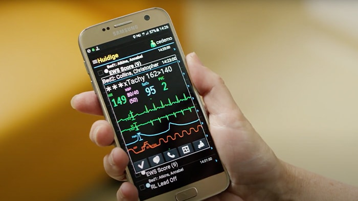 Using mobile devices to manage monitoring alarms with Philips CareEvent
