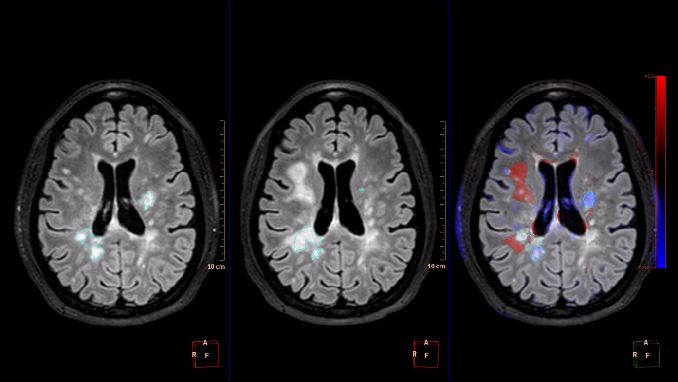 Comparative Brain Imaging download image