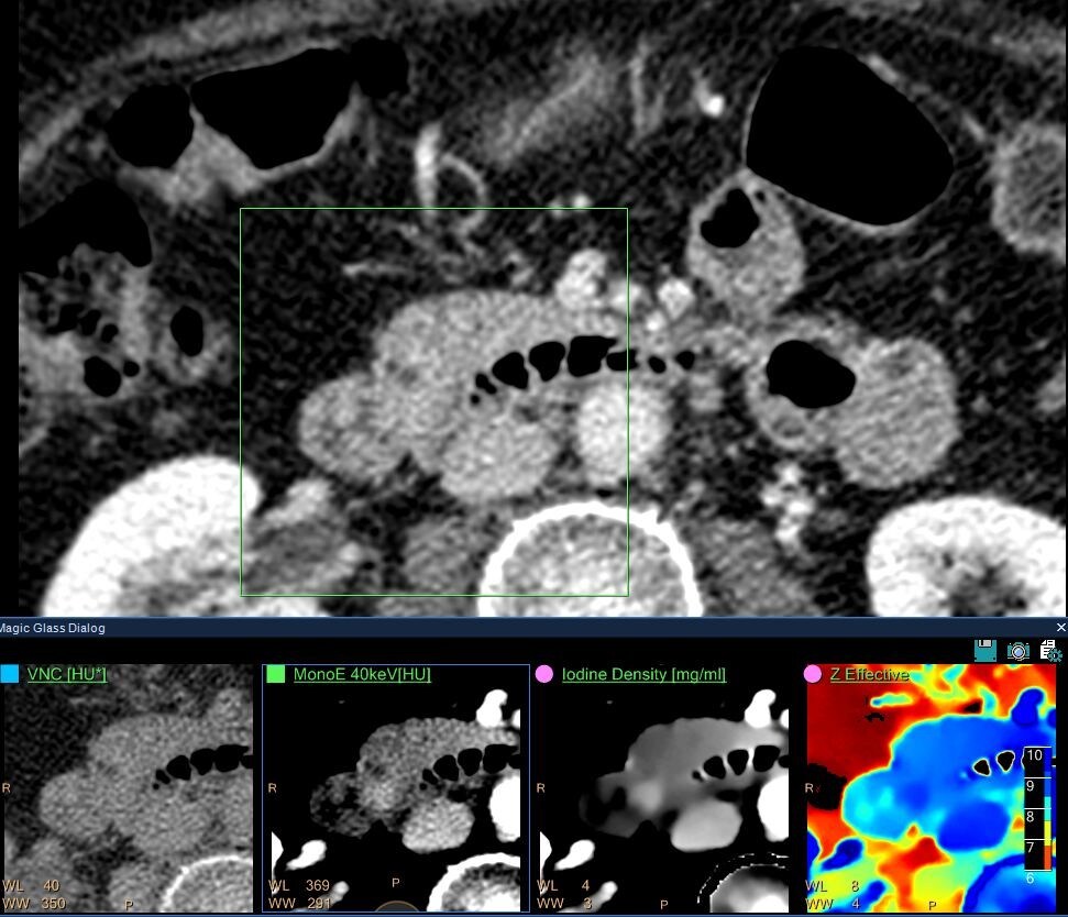 CT for the ED download image