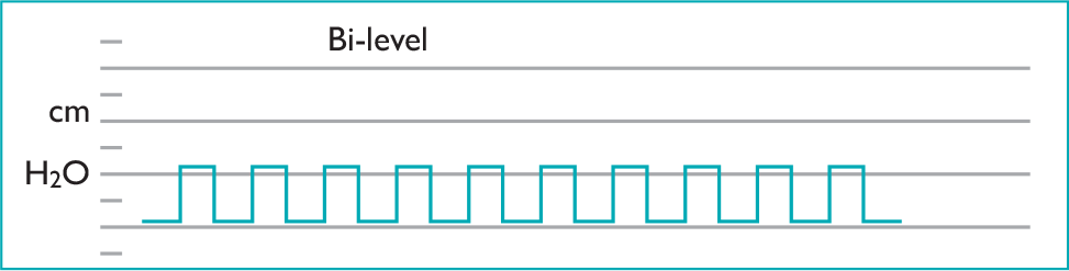 bipap graph