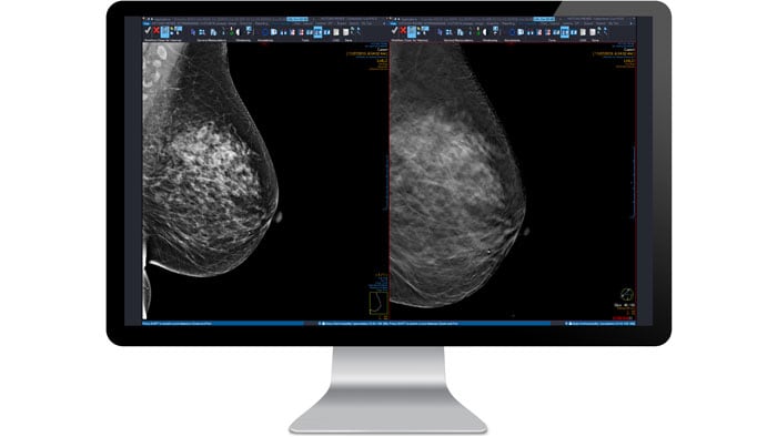 mammography no icon