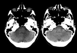 Clinical imaging