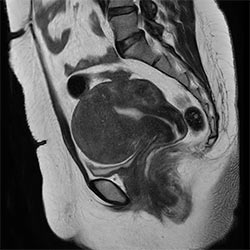 Pelvis image