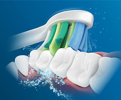 Clinical assessment of the Philips Sonicare InterCare brush head