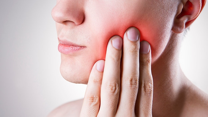 What is Periodontitis and How to Treat It