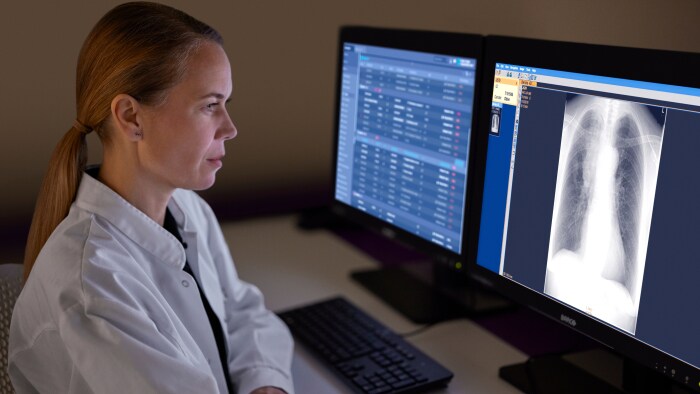 Philips Leads AI Transformation Lung cancer screening made smarter – Combining Leading Technology and AIin Healthcare, as we step into a new era of patient care