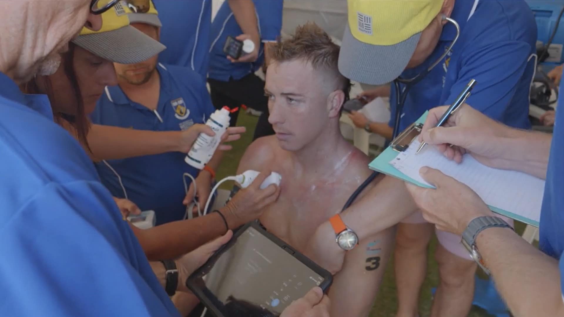 Philips Ultrasound Drives Landmark SIPE Research at Rottnest Swim