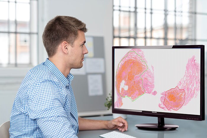 Download image (.jpg) Philips IntelliSite Pathology Solution (opens in a new window)