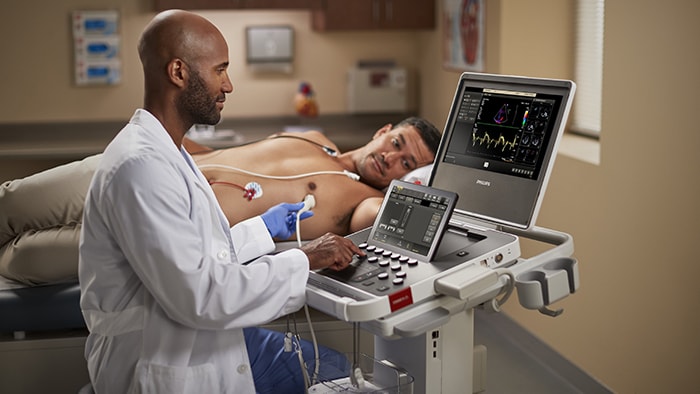 Philips integrates AI in cardiac ultrasound and across cardiac care at ESC 2023